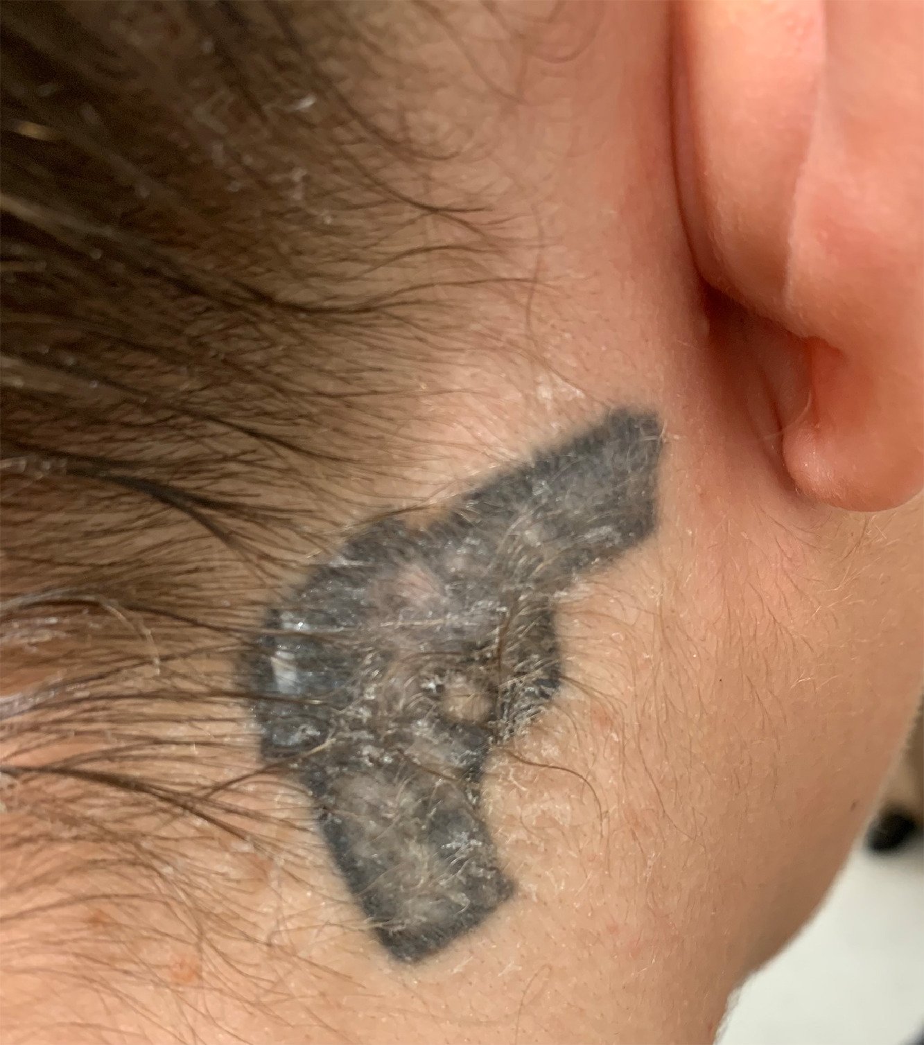 Photograph of an example of a tattoo on a human trafficking survivor