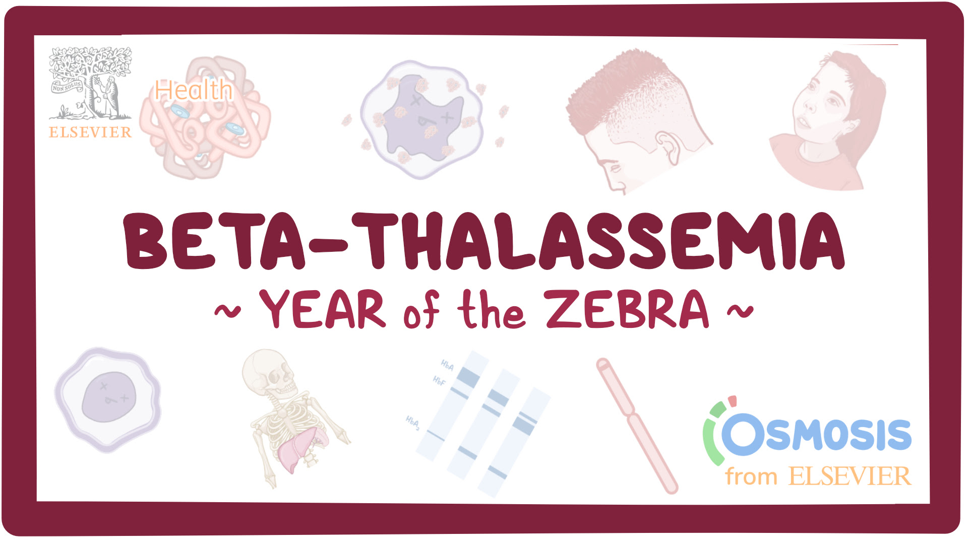 Beta-Thalassemia