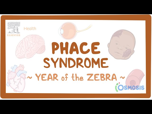 PHACE Syndrome