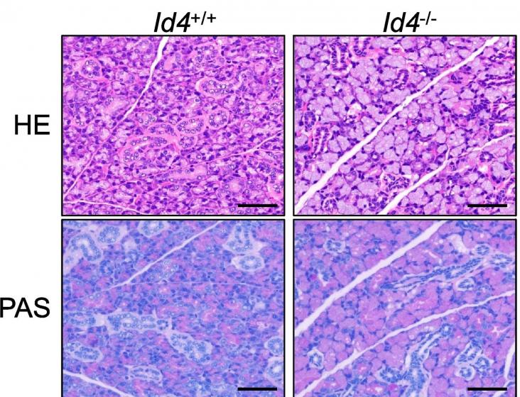 Hematoxylin and eosin (HE), PAS, and immunohistochemical staining for AQP5, CK14, α-SMA, CK19, and PCNA in the SMG of Id4+/+ (n = 3–5) and Id4−/− mice (n = 3–6) at P21.