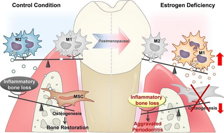 Graphical abstract showing the effect of estrogen-deficiency on a tooth