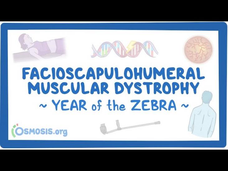 Facioscapulohumeral Muscular Dystrophy
