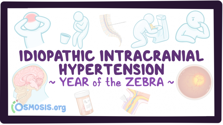  Idiopathic Intracranial Hypertension