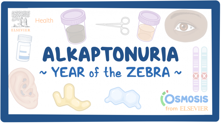Zebra of the Week: Alkaptonuria