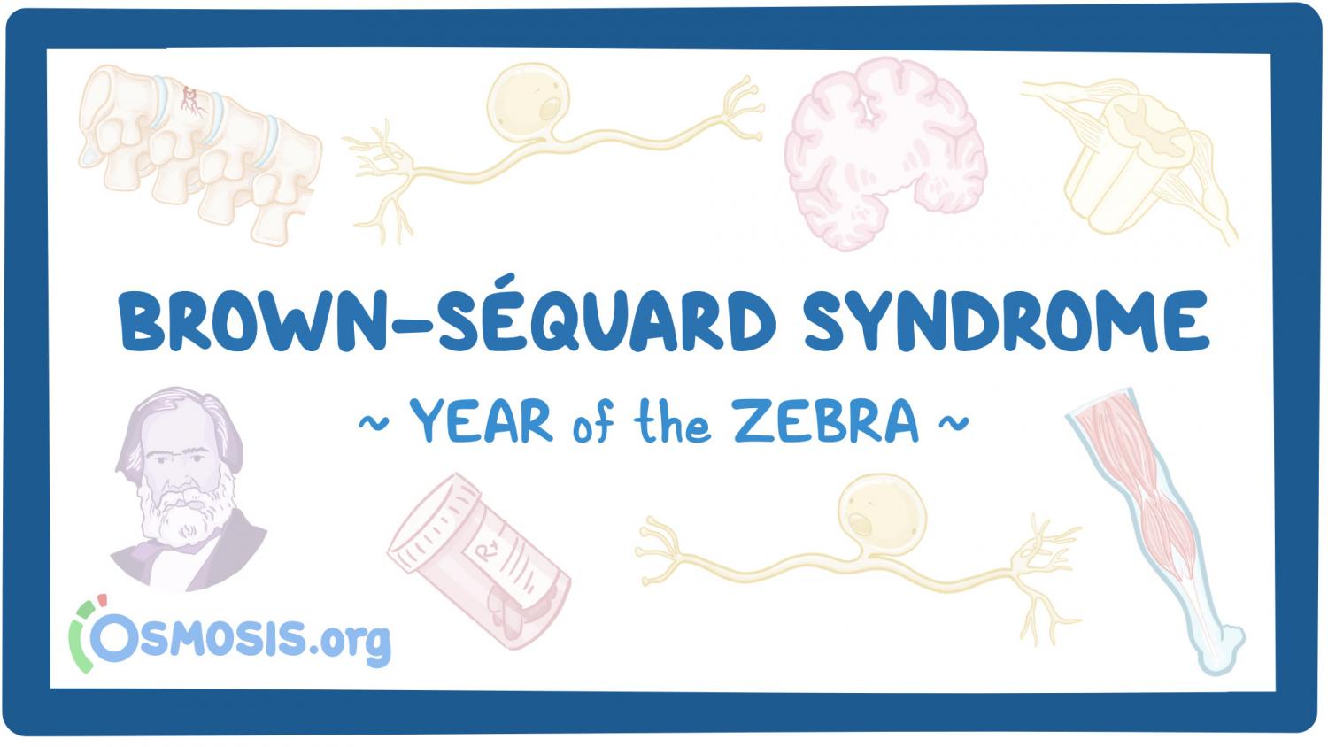 Brown-Sequard Syndrome