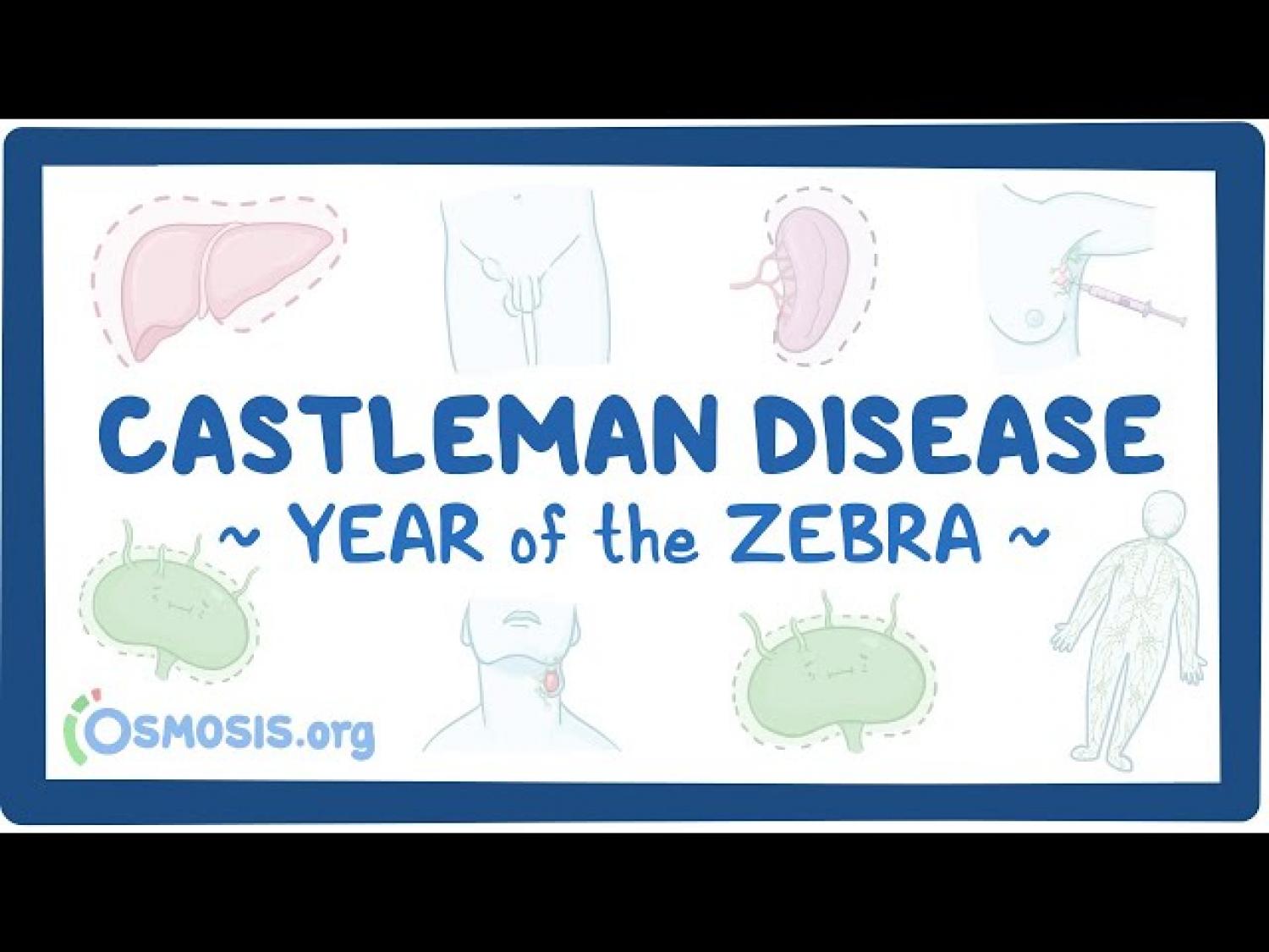 Castleman Disease
