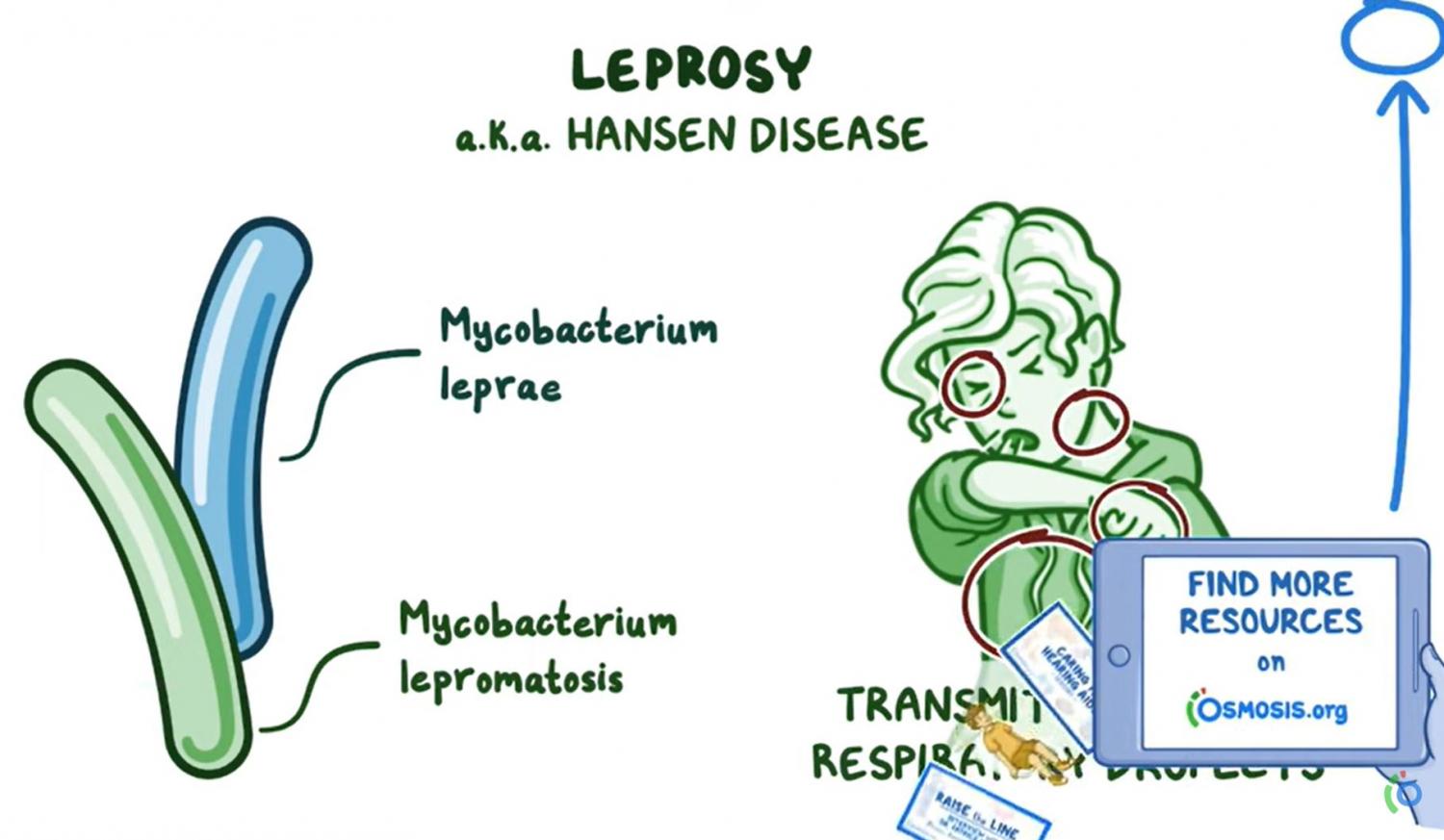 Diagram of leprosy