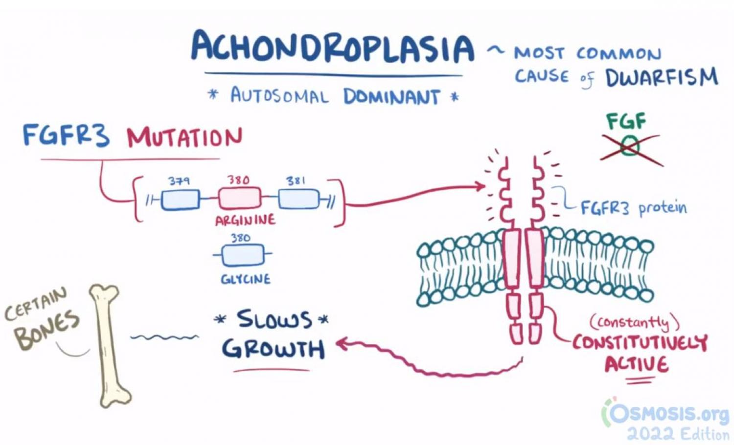 achondroplasia chromosome 4