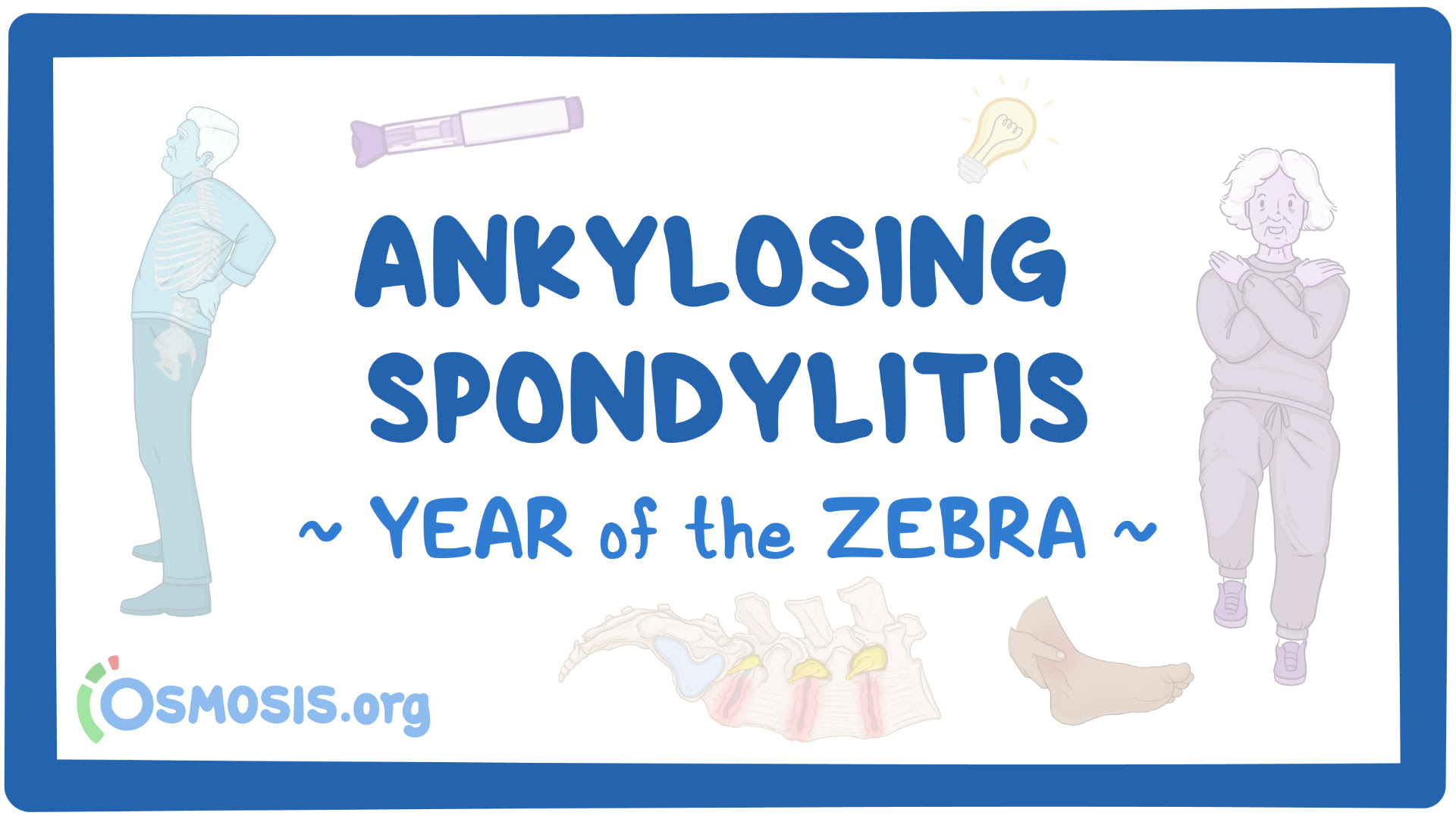 Zebra of the Year: Ankylosing Spondylitis