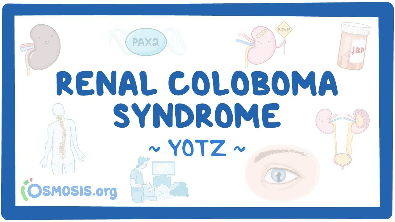 Zebra of the Year: Renal Coloboma Syndrome